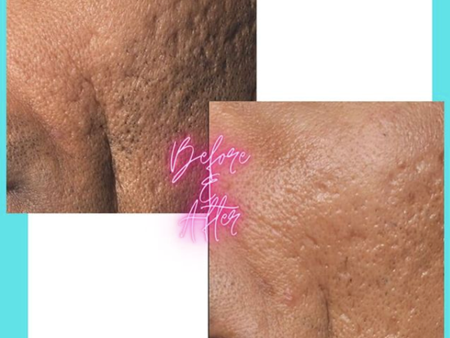 Heres Why You Should Come Visit Envy My Skin! 22062 hereand39s why you should come visit envy my skin 5